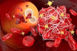 Chuyên gia chia sẻ 3 cách phòng ngừa khi cục máu đông xuất hiện